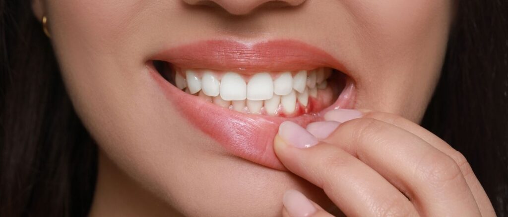 gum disease and heart problems