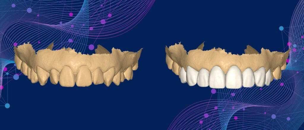 A Smile Designed in the Digital World...Brought to Life