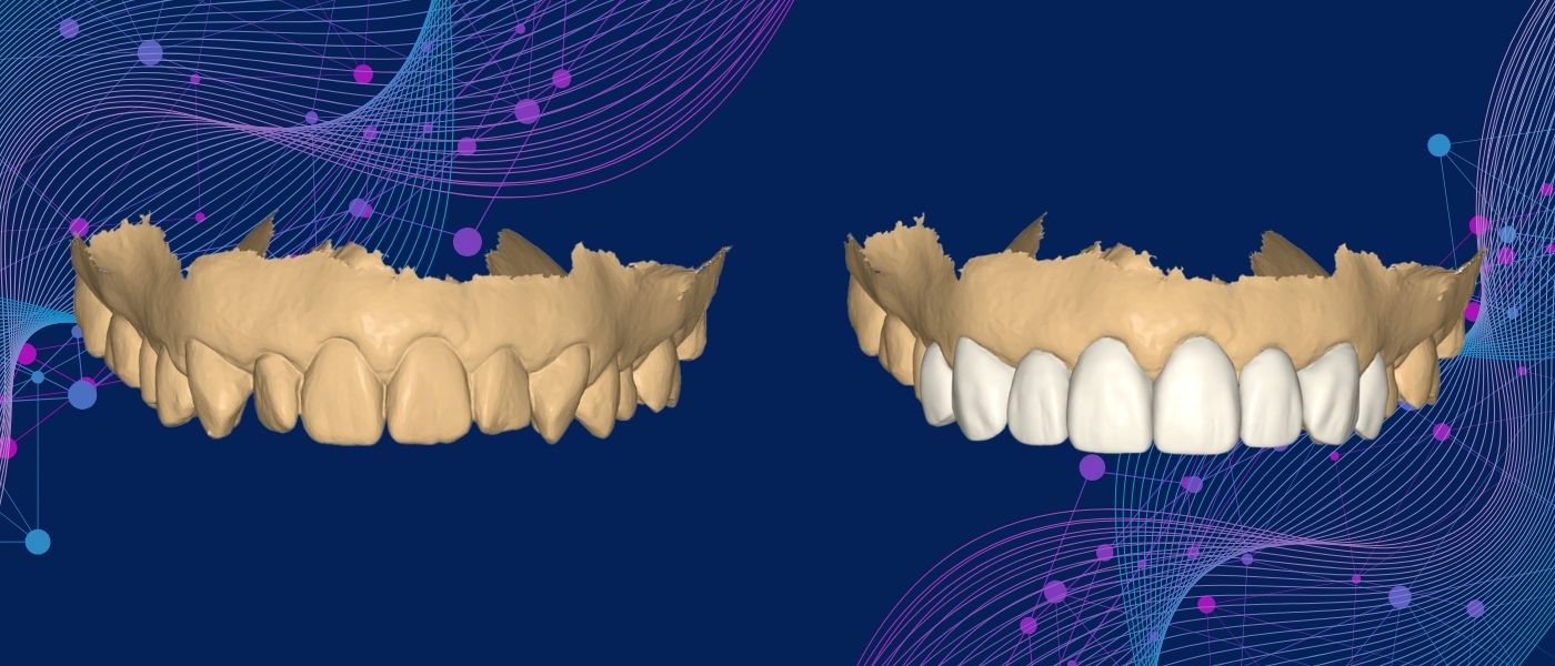 A Smile Designed in the Digital World...Brought to Life
